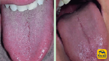 Conosciamo meglio la nostra lingua per una connessione tra corpo e bocca