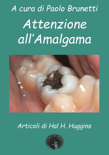 Attenzione all'Amalgama - Libro